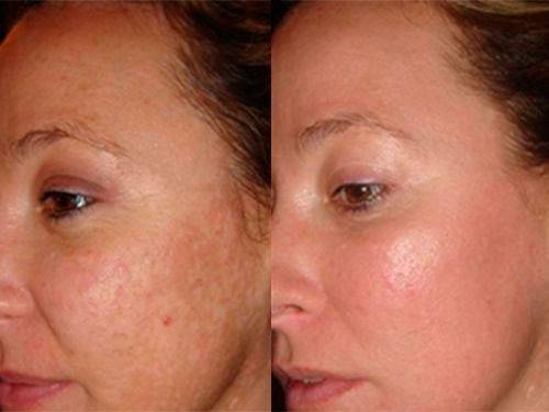 Мастер Spa массажей с большим опытом косметолог -эстетист 